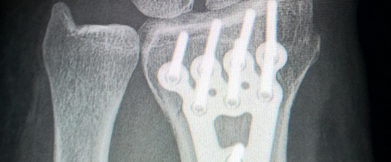 Titanium Titanium